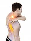 Silhouette eines Mannes mit Nackenschmerzen, konzeptionelle Illustration. — Stockfoto
