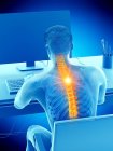 Rear view of working at desk male silhouette with back pain, conceptual illustration. — Stock Photo