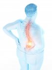 Ожирение мужского тела с болью в спине, цифровая иллюстрация . — стоковое фото