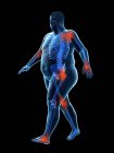 Силует ходьби ожиріння людини має суглобовий біль, комп'ютерна ілюстрація . — стокове фото