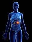 Corpo feminino com câncer de glândulas supra-renais, ilustração computacional . — Fotografia de Stock