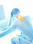 Trabalhador de escritório do sexo masculino na mesa com dor no pescoço, ilustração digital conceitual . — Fotografia de Stock