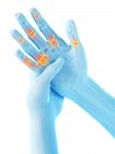 Abstrakte menschliche Hände mit Fingerschmerzen, konzeptionelle Illustration. — Stockfoto