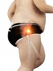 Silhouette di corridore obeso con dolore all'anca, illustrazione al computer . — Foto stock