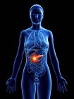 Рак підшлункової залози в жіночому тілі, концептуальний комп'ютерний приклад. — стокове фото