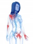Painful joints in female body, conceptual illustration. — Stock Photo