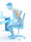 Sitzen am Schreibtisch Büroangestellte Silhouette mit Rückenschmerzen, konzeptionelle Illustration. — Stockfoto