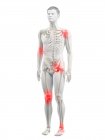 Cuerpo humano con puntos de dolor articular, ilustración conceptual . - foto de stock