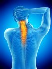 Männlicher Körper von hinten mit sichtbaren Nackenschmerzen, konzeptionelle Illustration. — Stockfoto