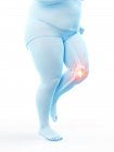 Silhouette de coureur obèse mâle ayant des douleurs au genou, illustration numérique conceptuelle . — Photo de stock