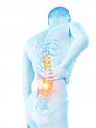 Male silhouette with back pain on white background, conceptual illustration. — Stock Photo