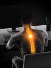 Visão traseira do trabalho na mesa silhueta masculina com dor nas costas, ilustração conceitual . — Fotografia de Stock