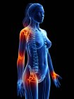 Silueta femenina con lugares de dolor articular, ilustración conceptual por ordenador . - foto de stock