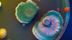Микробные колонии на чашке Петри, компьютерная иллюстрация — стоковое фото