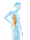 Vista lateral del cuerpo masculino con dolor de espalda sobre fondo blanco, ilustración conceptual . - foto de stock