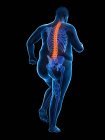 Ожиріння чоловічого тіла бігуна з болем у спині, концептуальна ілюстрація . — стокове фото