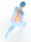 Hochwinkelaufnahme übergewichtiger Läufer mit Rückenschmerzen, digitale Illustration. — Stockfoto