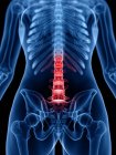 Human silhouette showing back pain, conceptual illustration. — Stock Photo