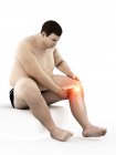 Silhouette d'un homme obèse assis souffrant de douleurs au genou, illustration d'ordinateur . — Photo de stock