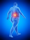 Andando silhueta masculina obesa com dor nas costas visível, ilustração digital . — Fotografia de Stock