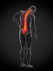 Visão traseira do corpo masculino com dor nas costas, ilustração conceitual . — Fotografia de Stock