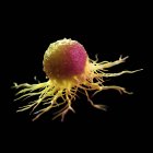 Célula de cáncer de color amarillo abstracto sobre fondo negro, ilustración digital . - foto de stock
