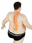 Fettleibige männliche Körper mit Rückenschmerzen in Hochwinkelansicht, digitale Illustration. — Stockfoto