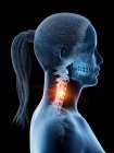 Abstract female body with detailed neck pain, conceptual digital illustration. — Stock Photo