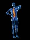 Vista frontal do corpo masculino com dor nas costas, ilustração conceitual . — Fotografia de Stock