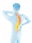 Male silhouette with back pain in high angle view, conceptual illustration. — Stock Photo