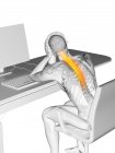 Наголошений офісний працівник з болем у спині, концептуальна ілюстрація . — стокове фото