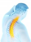 Close-up of obese male with back pain, digital illustration. — Stock Photo
