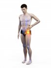 Silhouette of man having hip pain, digital illustration. — Stock Photo