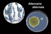 Ilustración digital de la morfología fúngica del hongo alergénico filamentoso Alternaria alternata y fotografía de colonias fúngicas en Sabouraud Dextrosa Agar . - foto de stock