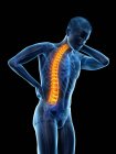 Biegung des männlichen Körpers mit Rückenschmerzen, konzeptionelle Illustration. — Stockfoto