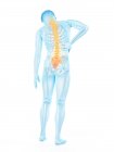 Vista trasera del cuerpo masculino con inflamación y dolor de espalda, ilustración conceptual . - foto de stock