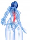 Abstrakte weibliche Silhouette mit Rückenschmerzen, konzeptionelle Illustration. — Stockfoto