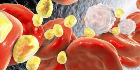 Illustration numérique des boules de lipides de cholestérol dans les vaisseaux sanguins
. — Photo de stock