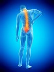 Вид сзади мужского тела с воспалением и болью в спине, концептуальная иллюстрация
. — стоковое фото