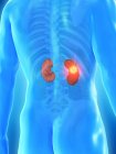 Nierenkrebs im männlichen Körper, konzeptionelle digitale Illustration. — Stockfoto