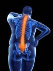 Fettleibige männliche Körper mit Rückenschmerzen, digitale Illustration. — Stockfoto