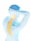Cuerpo masculino con dolor de cuello visible, ilustración conceptual . - foto de stock
