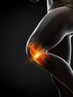 Corpo umano con dolore al ginocchio, illustrazione digitale concettuale . — Foto stock