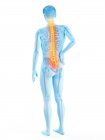 Silueta masculina con dolor de espalda sobre fondo blanco, ilustración conceptual . - foto de stock