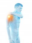 Silhueta do homem com dor no ombro, ilustração conceitual . — Fotografia de Stock