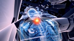 Ilustración de rayos X del riesgo de lesiones en el cuello durante un accidente de tráfico frontal, ilustraciones digitales . - foto de stock