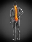 Male silhouette with back pain on grey background, conceptual illustration. — Stock Photo