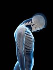 Silhouette maschile che mostra l'anatomia della lesione al collo, illustrazione digitale . — Foto stock