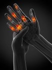 Mãos humanas abstratas com dor nos dedos, ilustração conceitual . — Fotografia de Stock