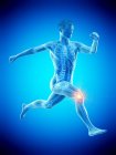 Runner silhouette with knee pain, digital illustration. — Stock Photo